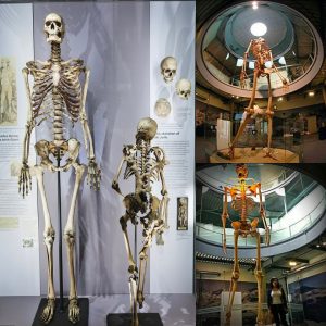 Irish Giant Charles Byrne's Skeleton Won't Be Exhibited at the Hunterian Museum in London