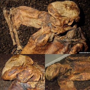 Lindow Man: Preserved Body of Centuries-Old Man Unearthed - NEWS