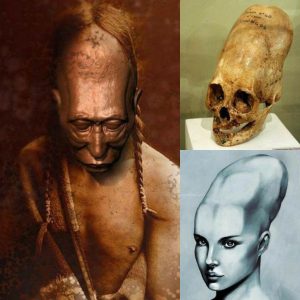 Breaking: The Longest Human Skull: Exploring Ancient Surgical Techniques and Beauty Standards.
