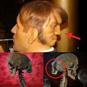 Breaking: Unveiling the Mystery: Archaeologists Analyze Autopsy Findings of the Two-Headed Skull